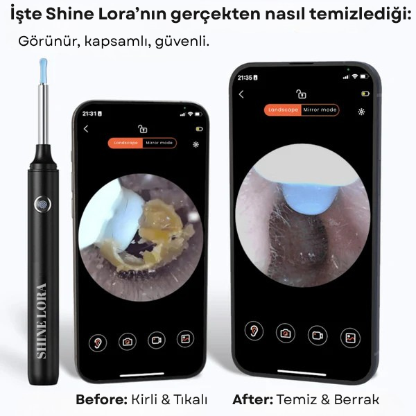 Shine Lora Kulak Temizleyici