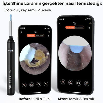 Shine Lora Kulak Temizleyici